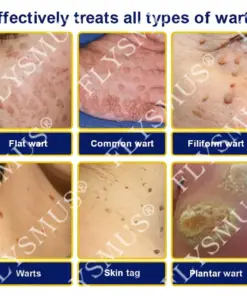 FLYSMUS® SKIN TAG CRYO TREATMENT SPRAY ACE