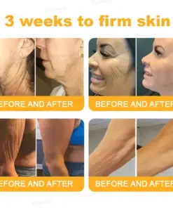 Flysmus® Botox Bee Venom Wrinkle Firming Multi-Purpose Cream