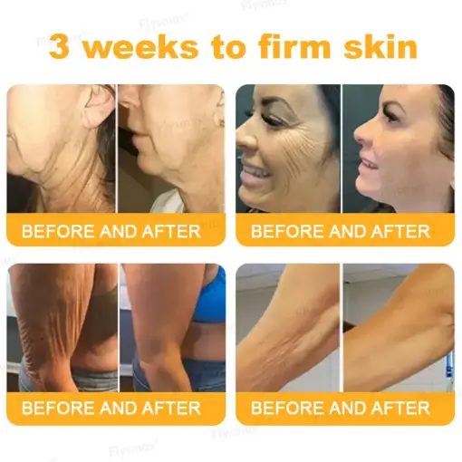 Flysmus® Botox Bee Venom Wrinkle Firming Multi-Purpose Cream
