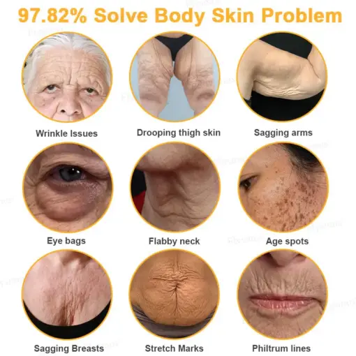 Flysmus® Botox Bee Venom Wrinkle Firming Multi-Purpose Cream