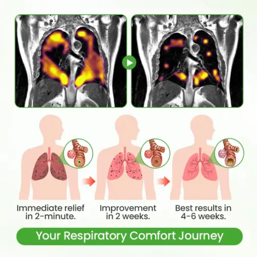 Flysmus® HerbaAir Mullein Lung Purifier