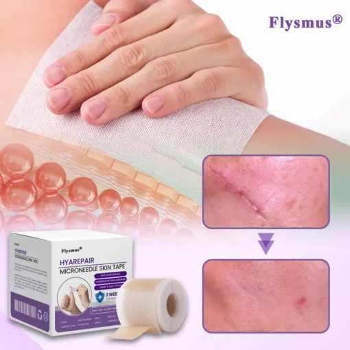 Flysmus® HyaRepair Microneedle Skin Tape