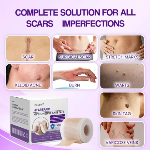 Flysmus® HyaRepair Microneedle Skin Tape