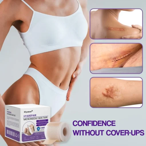 Flysmus® HyaRepair Microneedle Skin Tape