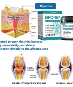 𝐟𝐥𝐲𝐬𝐦𝐮𝐬® 𝐁𝐏𝐂-𝟏𝟓𝟕 𝐉𝐨𝐢𝐧𝐭 𝐇𝐞𝐚𝐥𝐢𝐧𝐠 𝐂𝐫𝐞𝐚𝐦