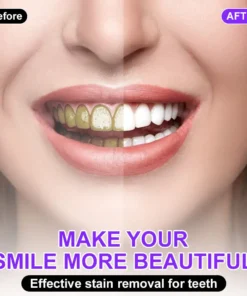 𝐅𝐥𝐲𝐬𝐦𝐮𝐬® 𝐂𝐨𝐥𝐨𝐮𝐫 𝐂𝐨𝐫𝐫𝐞𝐜𝐭𝐨𝐫 𝐒𝐞𝐫𝐮𝐦