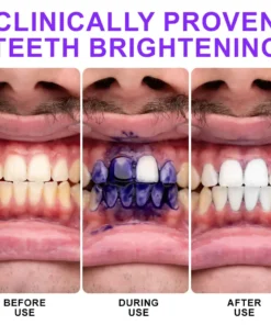 𝐅𝐥𝐲𝐬𝐦𝐮𝐬® 𝐂𝐨𝐥𝐨𝐮𝐫 𝐂𝐨𝐫𝐫𝐞𝐜𝐭𝐨𝐫 𝐒𝐞𝐫𝐮𝐦