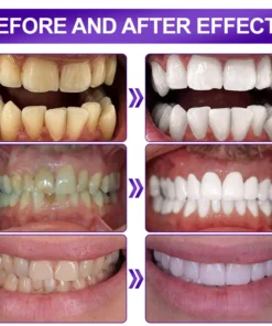 𝐅𝐥𝐲𝐬𝐦𝐮𝐬® 𝐕𝟑𝟒 𝐖𝐇𝐈𝐓𝐄𝐍𝐈𝐍𝐆 𝐒𝐓𝐑𝐈𝐏𝐒