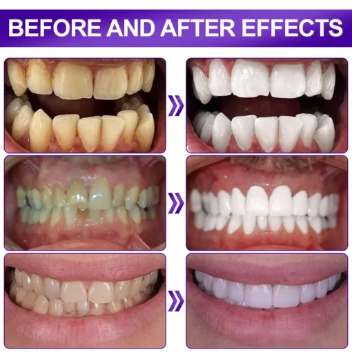 𝐅𝐥𝐲𝐬𝐦𝐮𝐬® 𝐕𝟑𝟒 𝐖𝐇𝐈𝐓𝐄𝐍𝐈𝐍𝐆 𝐒𝐓𝐑𝐈𝐏𝐒