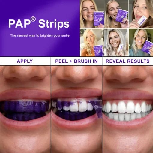 𝐅𝐥𝐲𝐬𝐦𝐮𝐬® 𝐕𝟑𝟒 𝐖𝐇𝐈𝐓𝐄𝐍𝐈𝐍𝐆 𝐒𝐓𝐑𝐈𝐏𝐒
