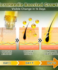 Flysmus® Microneedle Herbal Infusion Hair Stimulation Set