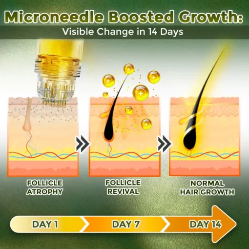 Flysmus® Microneedle Herbal Infusion Hair Stimulation Set