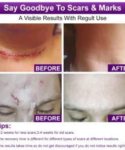 flysmus® cure FACE & BODY SCAR GEL