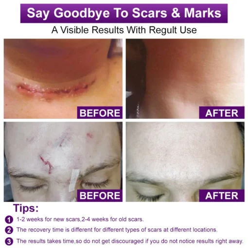flysmus® cure FACE & BODY SCAR GEL