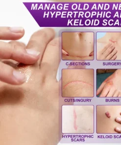 flysmus® cure FACE & BODY SCAR GEL