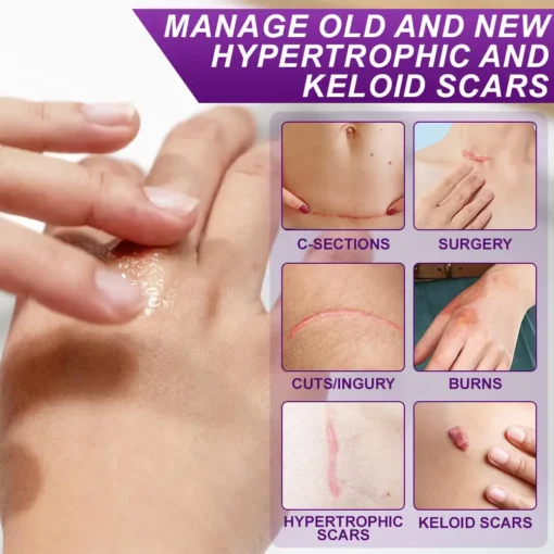 flysmus® cure FACE & BODY SCAR GEL