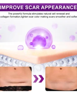 flysmus® cure FACE & BODY SCAR GEL