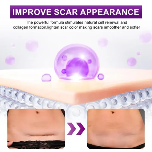 flysmus® cure FACE & BODY SCAR GEL