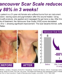flysmus® cure FACE & BODY SCAR GEL
