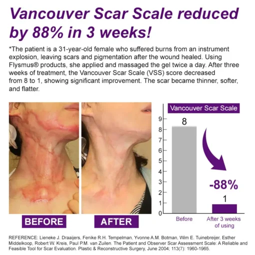 flysmus® cure FACE & BODY SCAR GEL