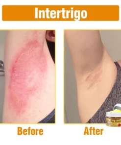 flysmus® Bee Venom Comprehensive Cream Made in UK