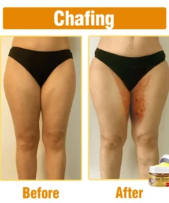 flysmus® Bee Venom Comprehensive Cream Made in UK