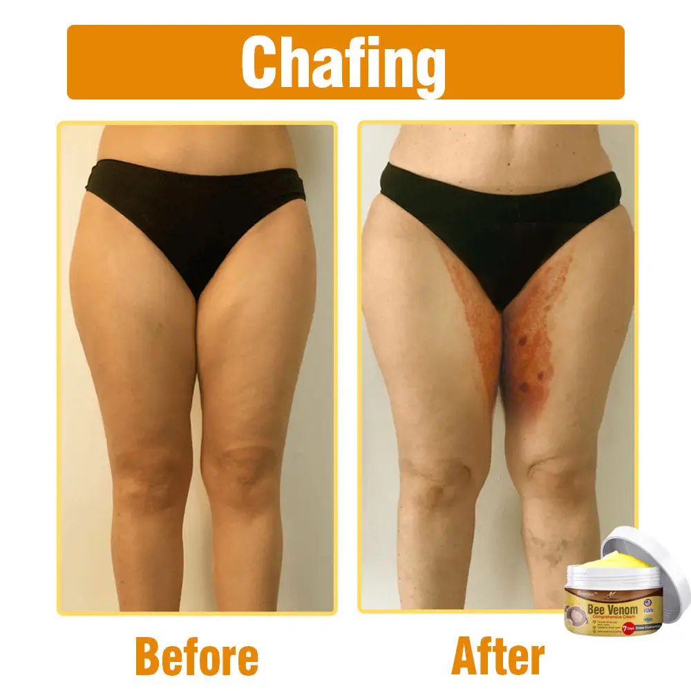 flysmus® Bee Venom Comprehensive Cream Made in UK