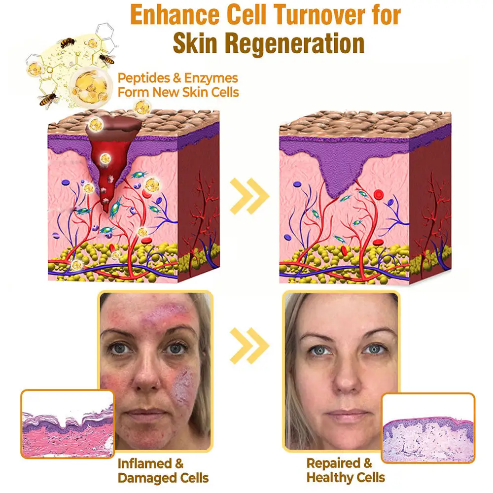 flysmus® Bee Venom Comprehensive Cream Made in UK