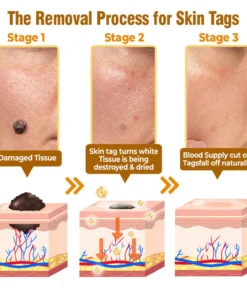 flysmus® Bee Venom Comprehensive Cream Made in UK