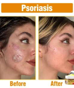 flysmus® Bee Venom Comprehensive Cream Made in UK