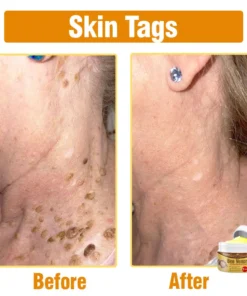 flysmus® Bee Venom Comprehensive Cream Made in UK