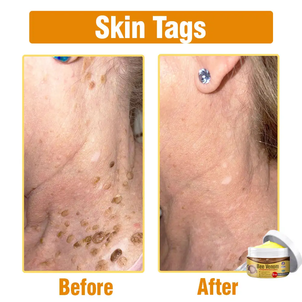 flysmus® Bee Venom Comprehensive Cream Made in UK