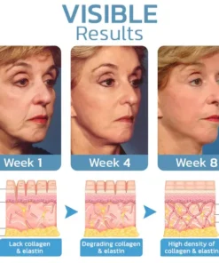 flysmus™ BotoxLUX Anti Aging Serum