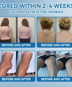 Flysmus® Hyaluronic Acid Fast Comfort Joint Cream