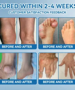 Flysmus® Hyaluronic Acid Fast Comfort Joint Cream