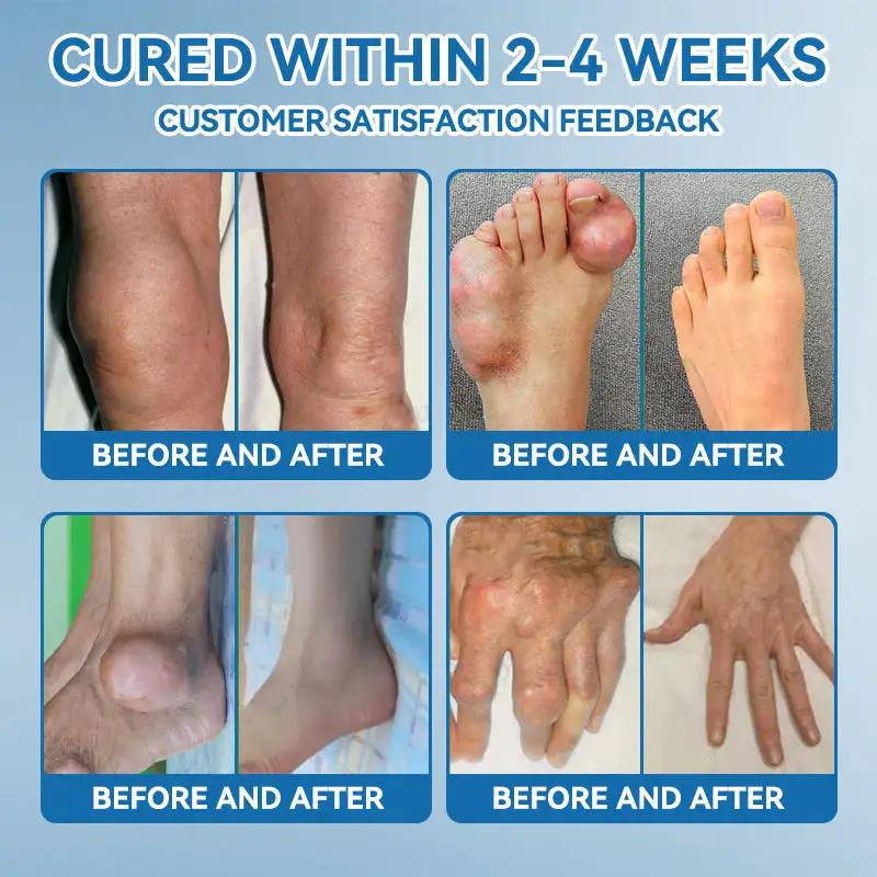 Flysmus® Hyaluronic Acid Fast Comfort Joint Cream